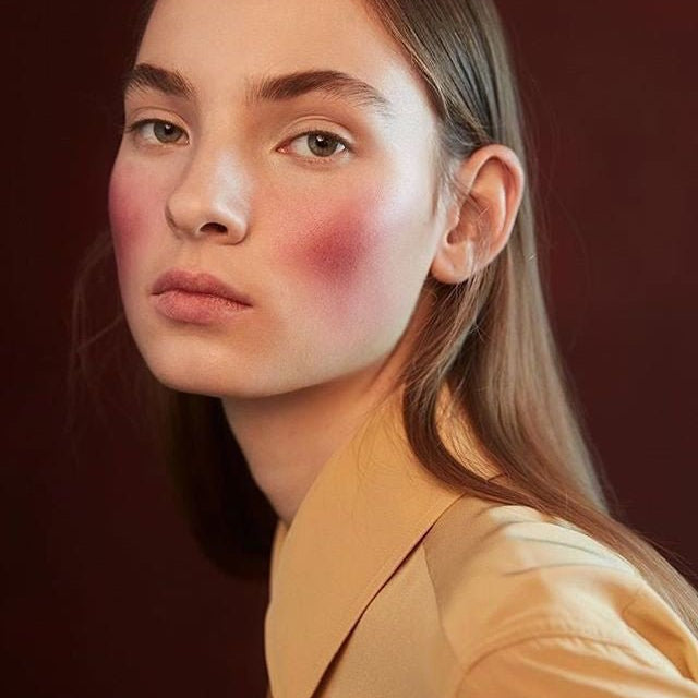 Rosacea: What is this & what you need to know about it? - Skin Love Cream