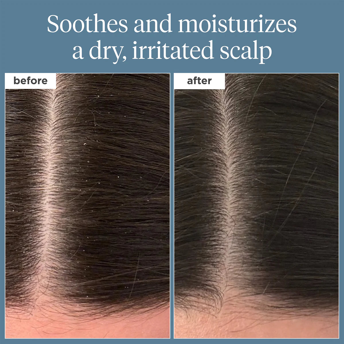 Briogeo Scalp Revival Pre-Wash Oil