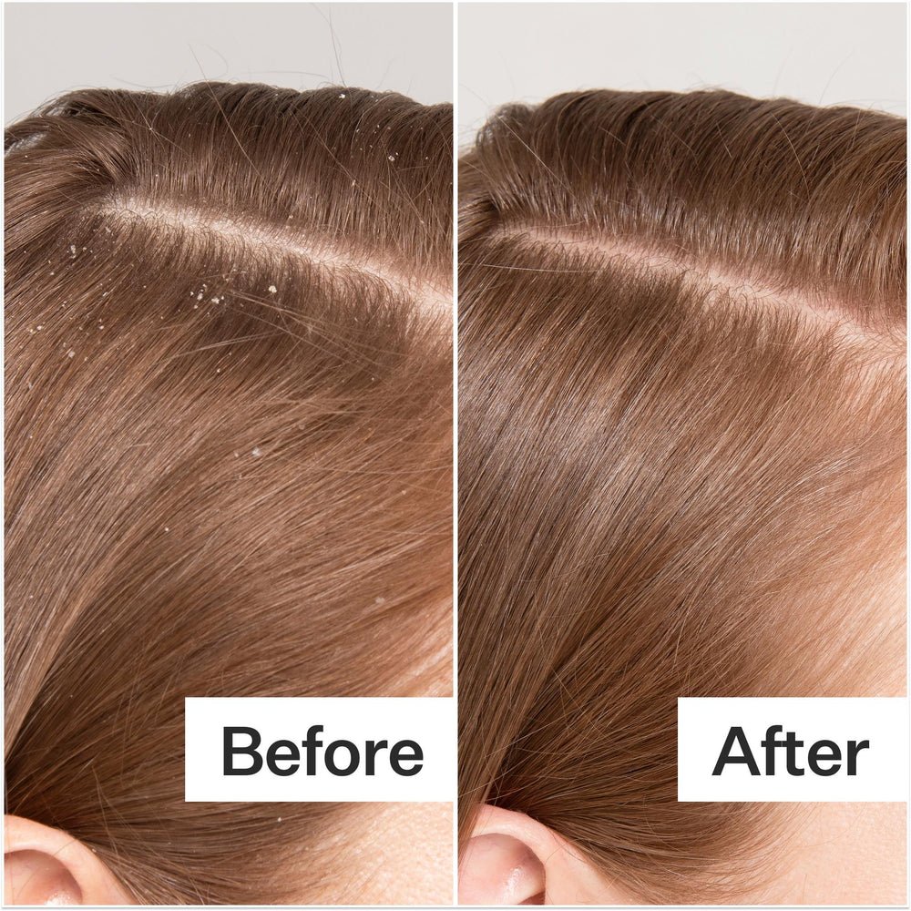 Act+Acre Cold Processed Scalp Detox Oil - Skin Love Cream