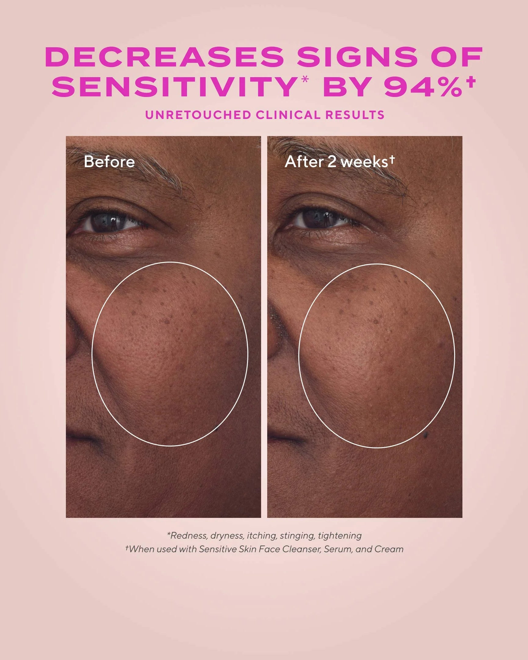 Murad Heartleaf Calming Cream - Skin Love Cream