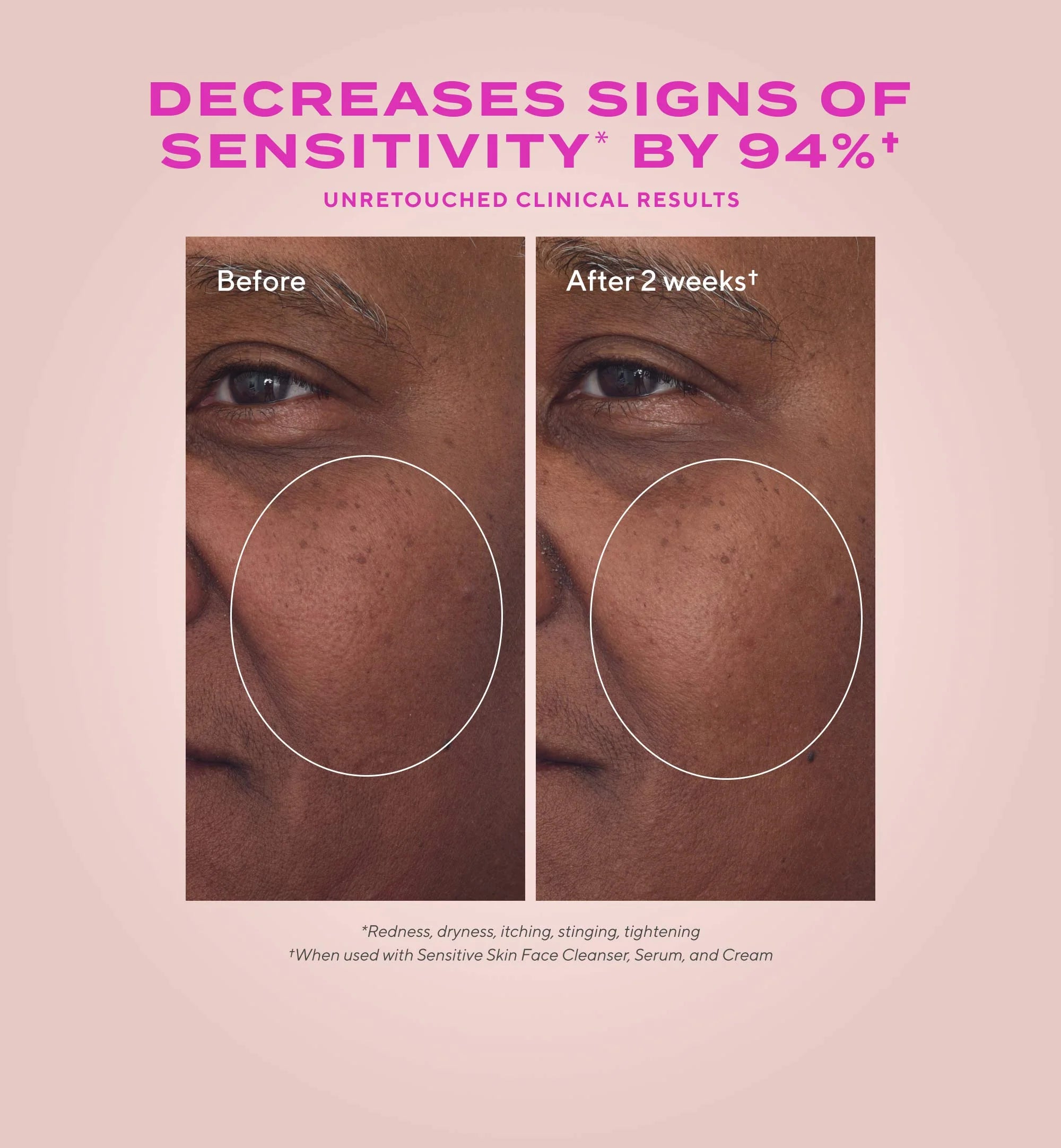 Murad Heartleaf Calming Cream - Skin Love Cream