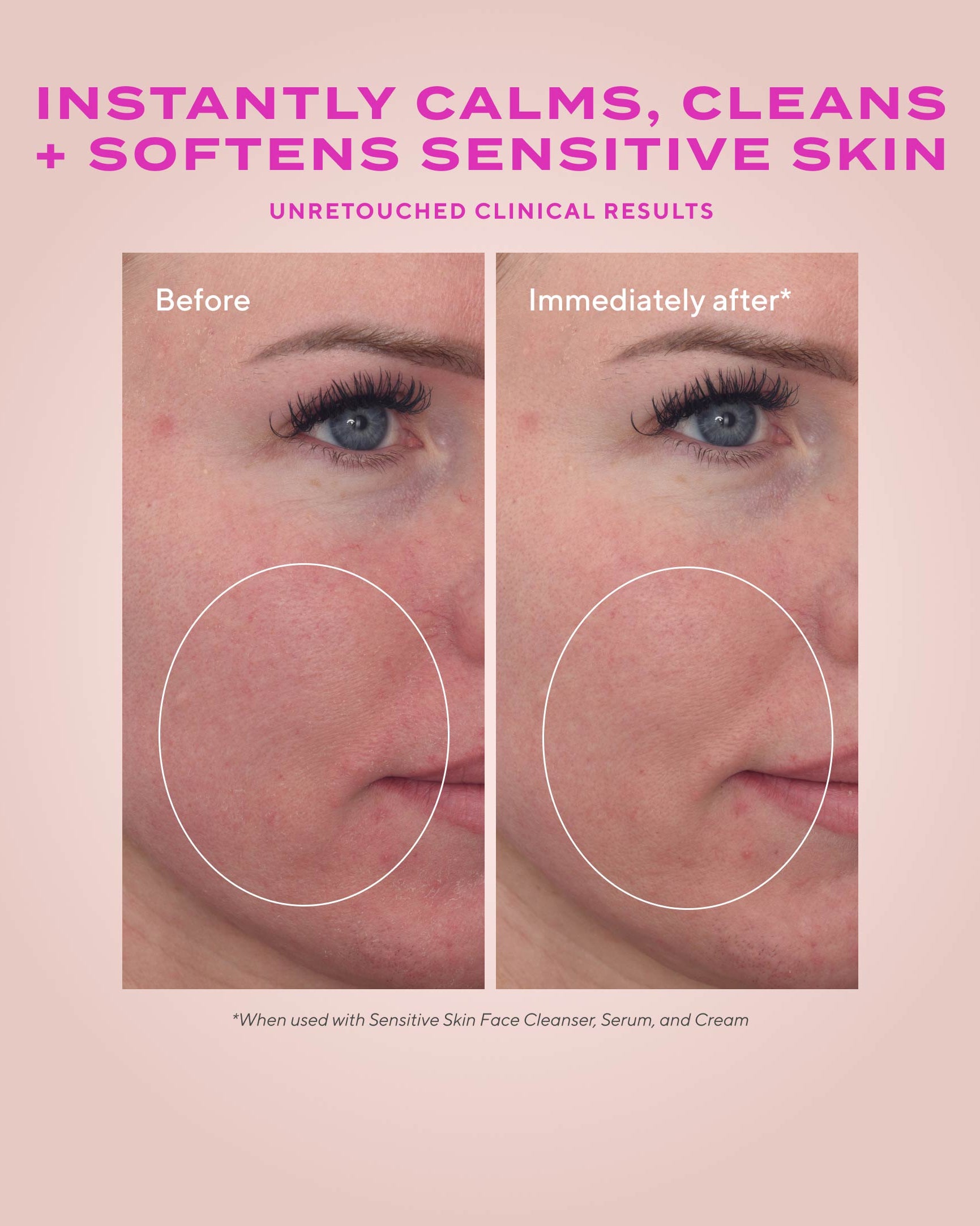 Murad Heartleaf Soothing Cleanser - Skin Love Cream