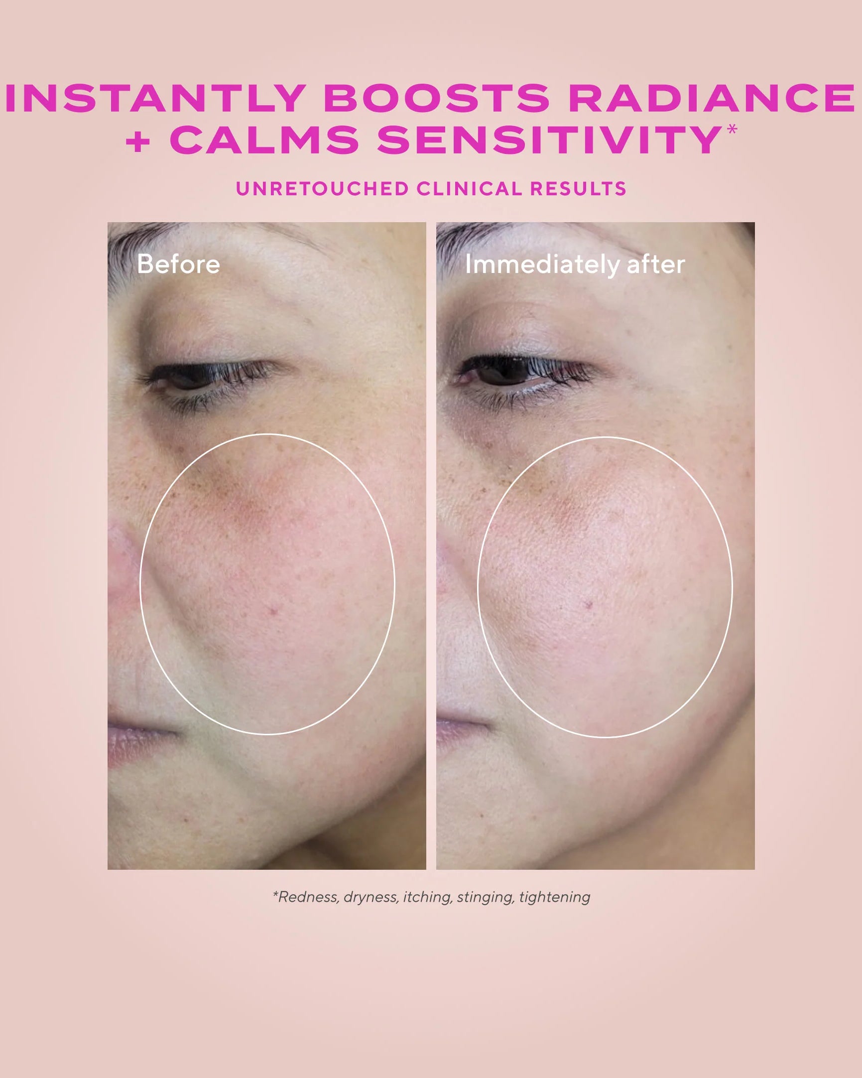 Murad Heartleaf Gentle Resurfacing Serum - Skin Love Cream