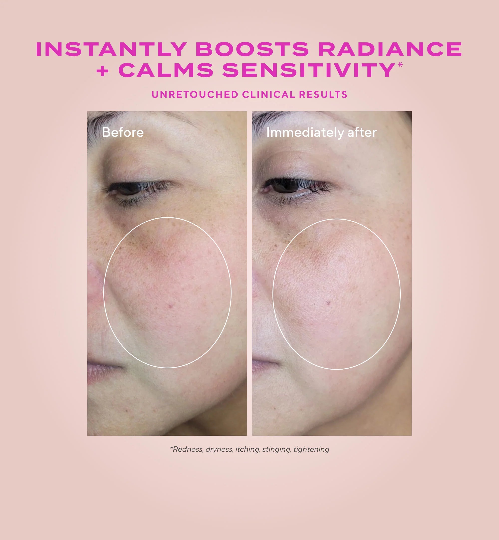 Murad Heartleaf Gentle Resurfacing Serum - Skin Love Cream