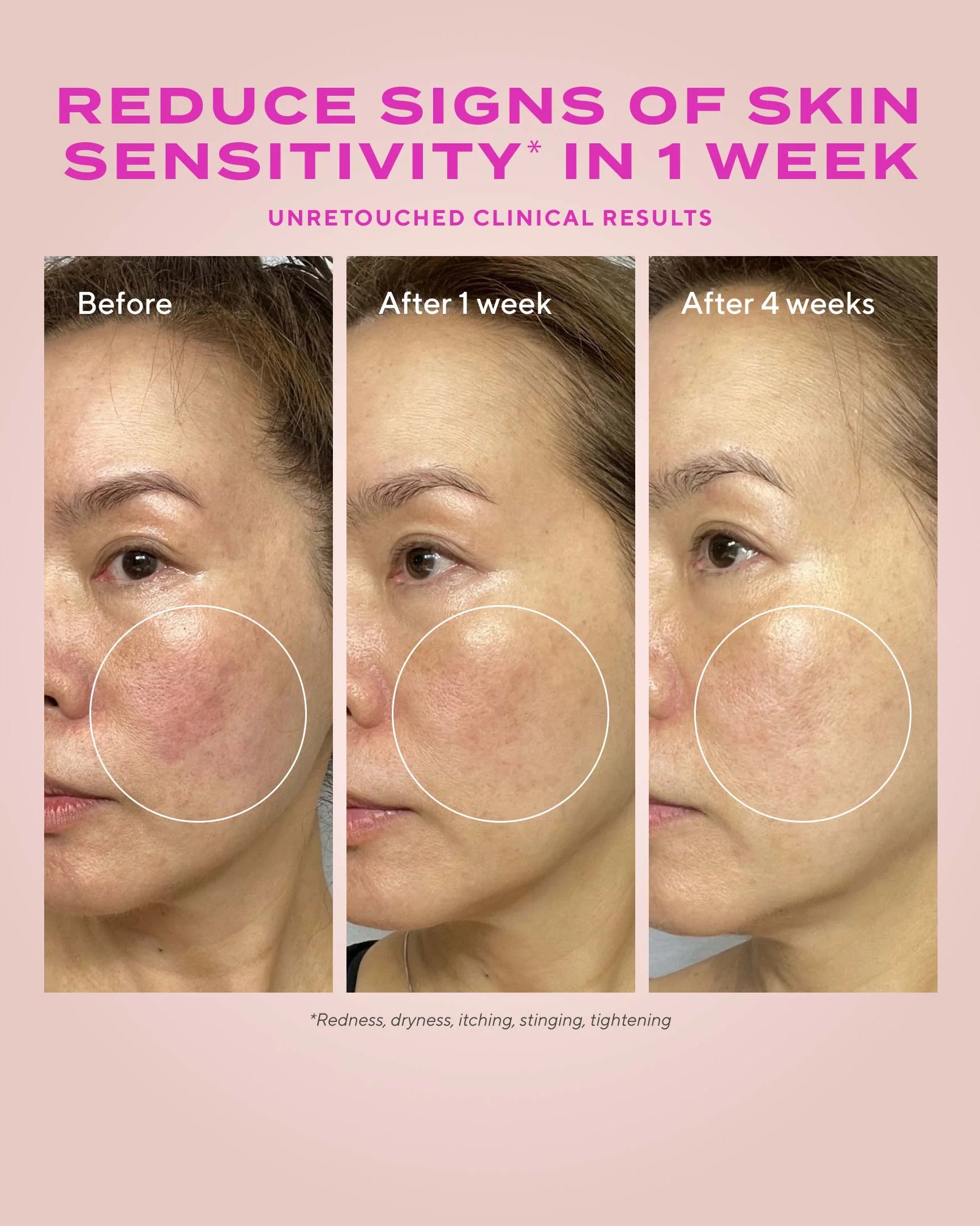 Murad Heartleaf Gentle Resurfacing Serum - Skin Love Cream