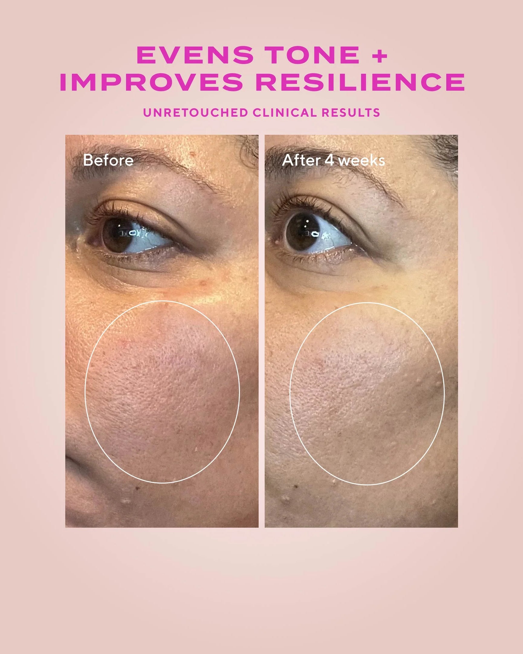 Murad Heartleaf Gentle Resurfacing Serum - Skin Love Cream