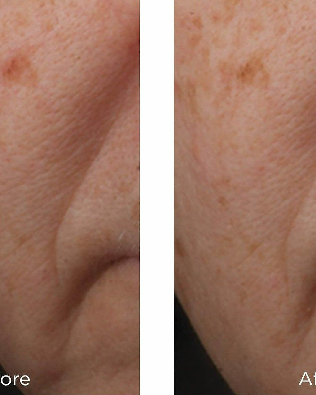 Perricone MD Cold Plasma Plus+ Advanced Serum Concentrate - Skin Love Cream