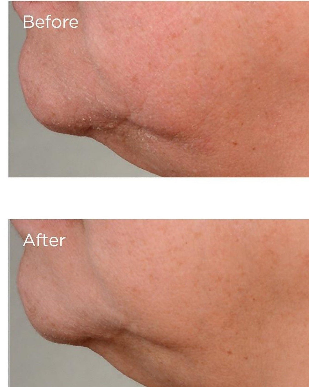 Perricone MD High Potency Growth Factor Firming & Lifting Serum - Skin Love Cream