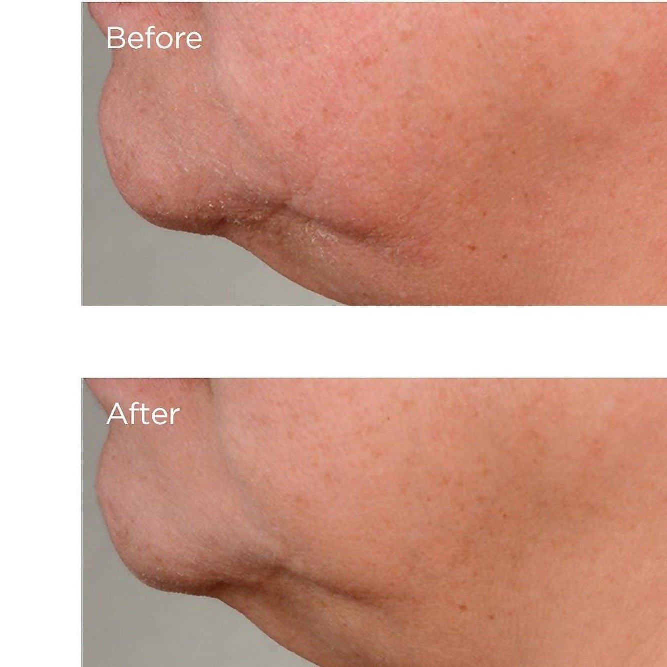 Perricone MD High Potency Growth Factor Firming & Lifting Serum - Skin Love Cream