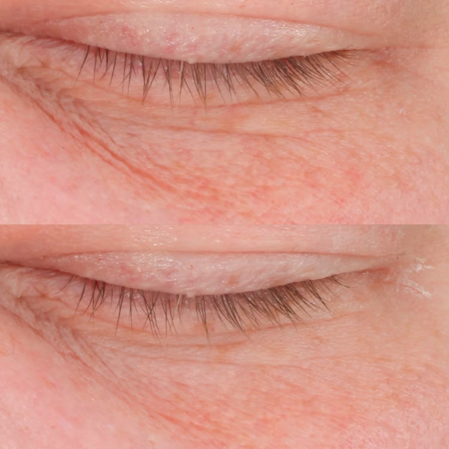 Perricone MD Cold Plasma Plus+ Advanced Eye Cream - Skin Love Cream