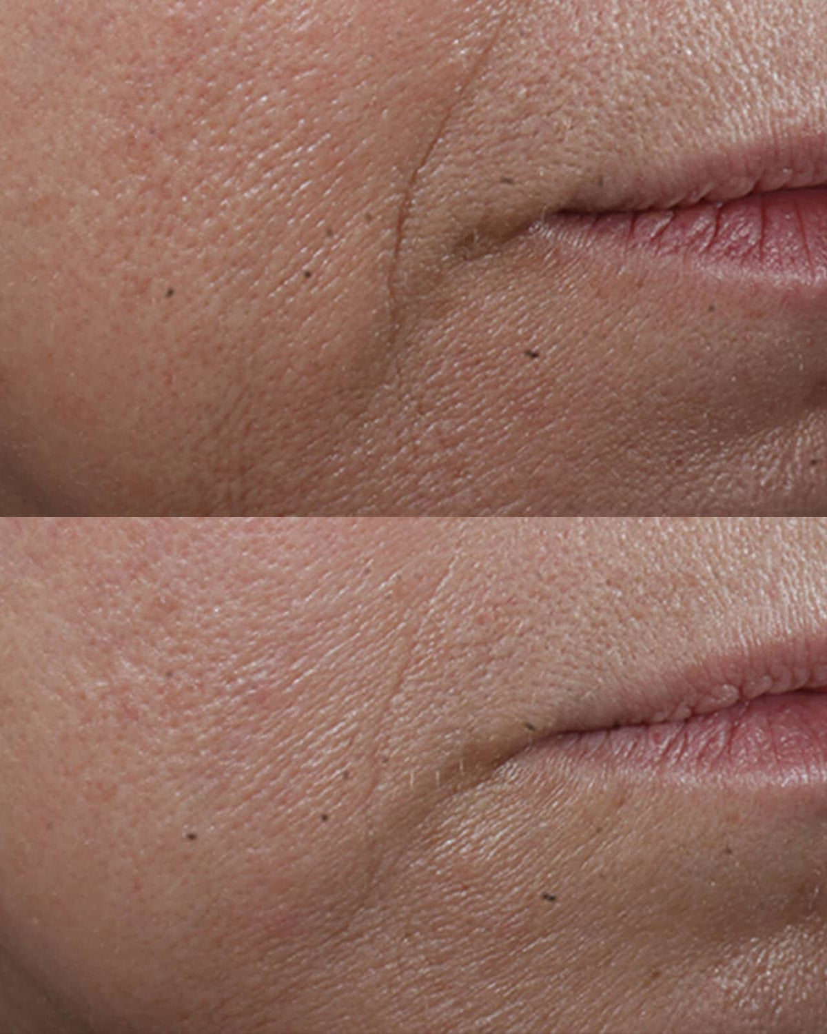 Perricone MD Cold Plasma Plus+ Advanced Serum Concentrate - Skin Love Cream