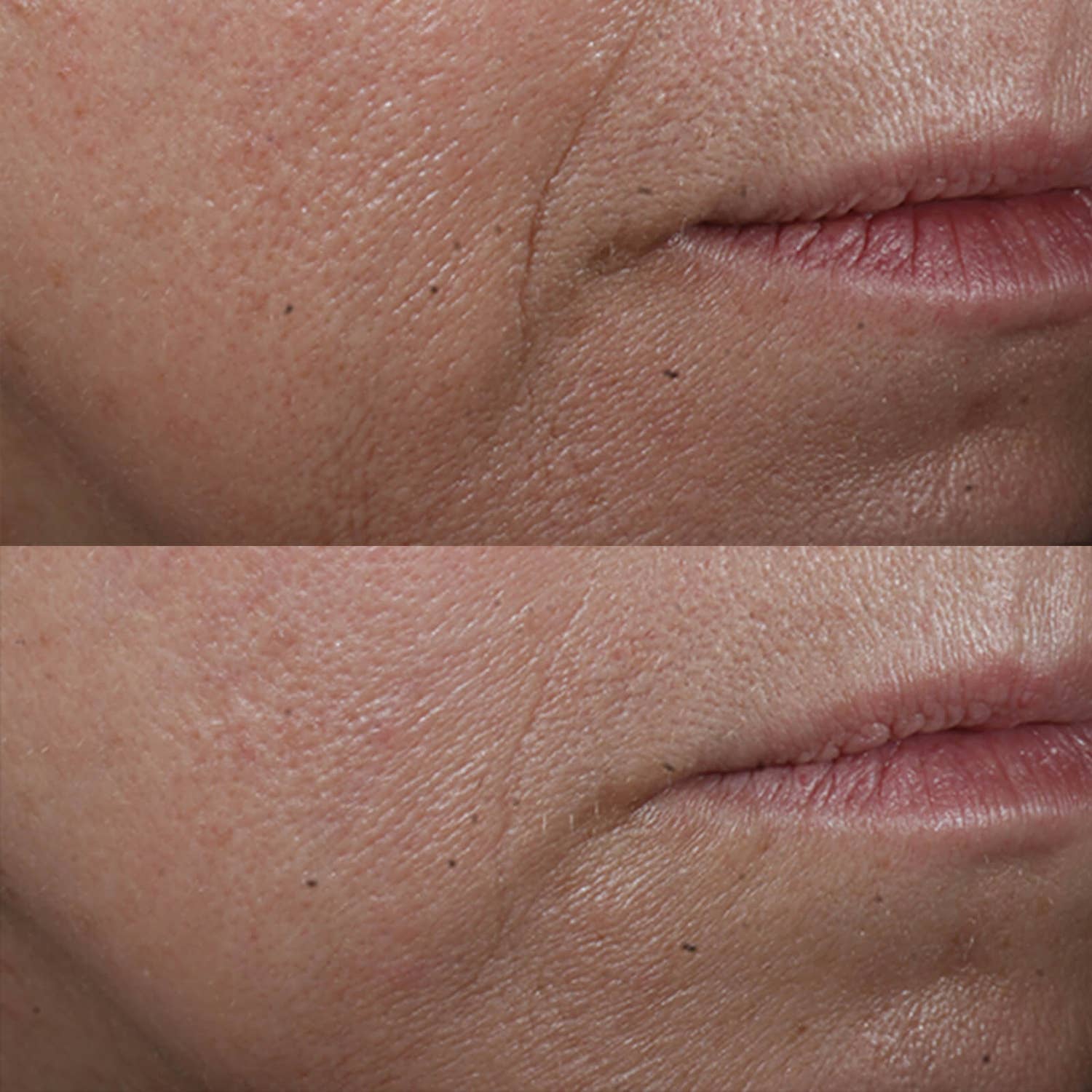 Perricone MD Cold Plasma Plus+ Advanced Serum Concentrate - Skin Love Cream