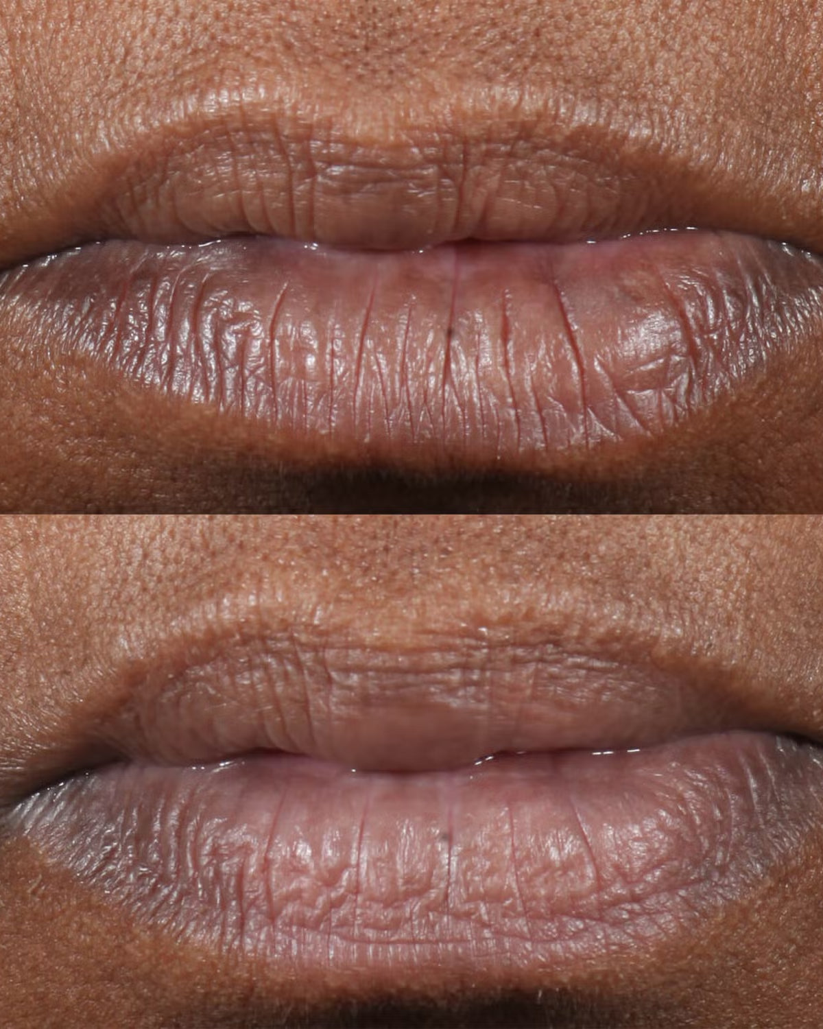 Perricone MD Cold Plasma Plus+ Lip Therapy - Skin Love Cream