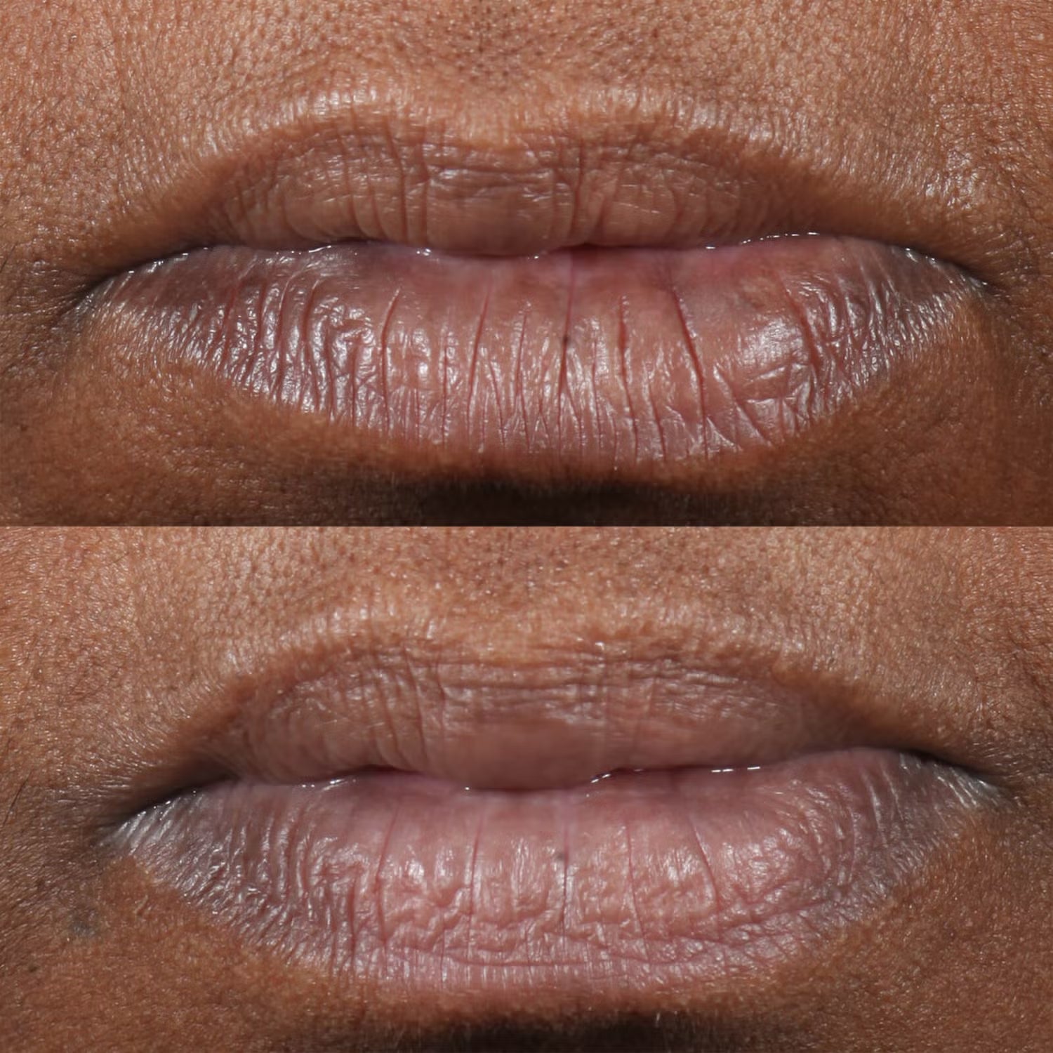 Perricone MD Cold Plasma Plus+ Lip Therapy - Skin Love Cream