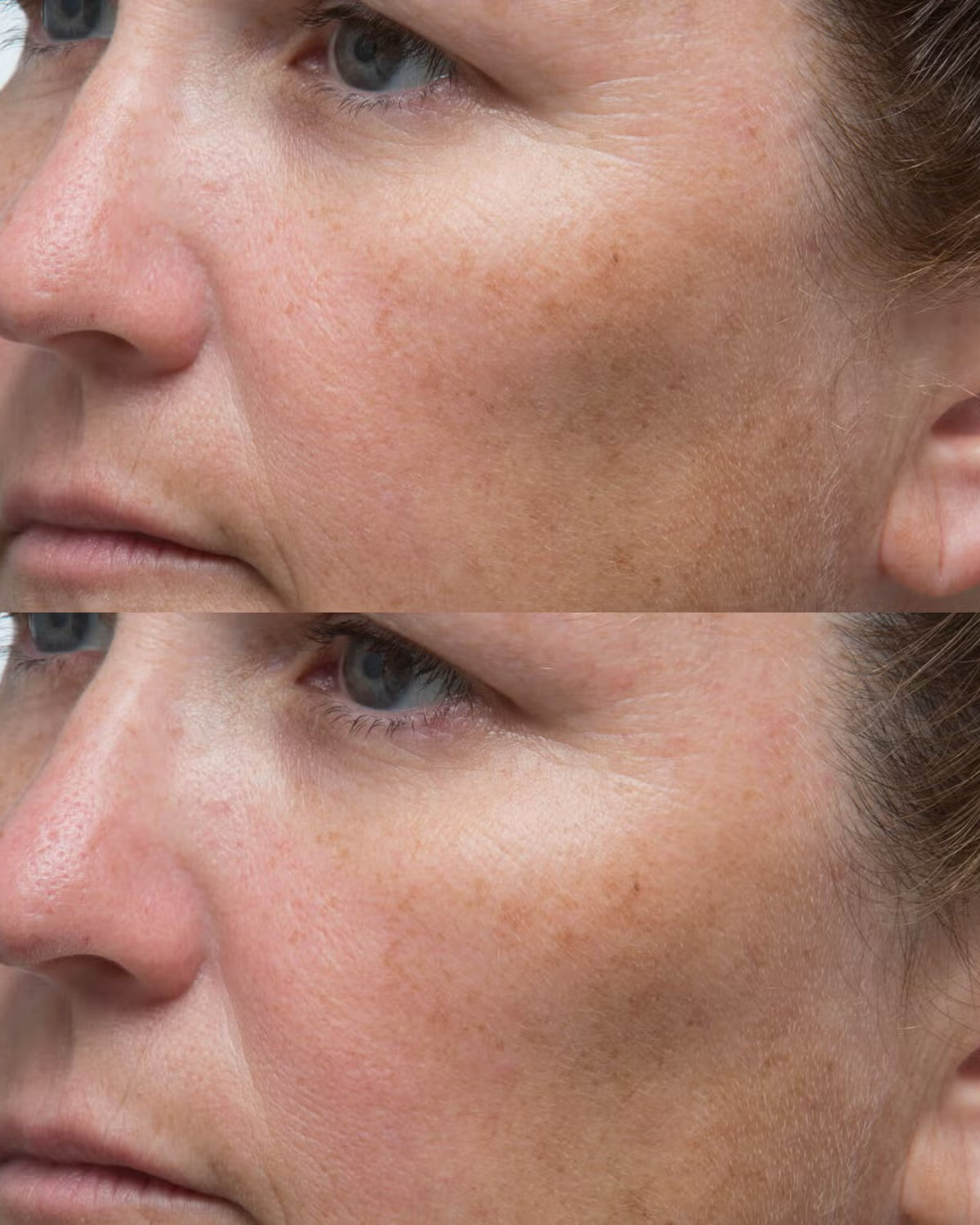 Perricone MD High Potency Classics Hyaluronic Intensive Moisturizer - Skin Love Cream