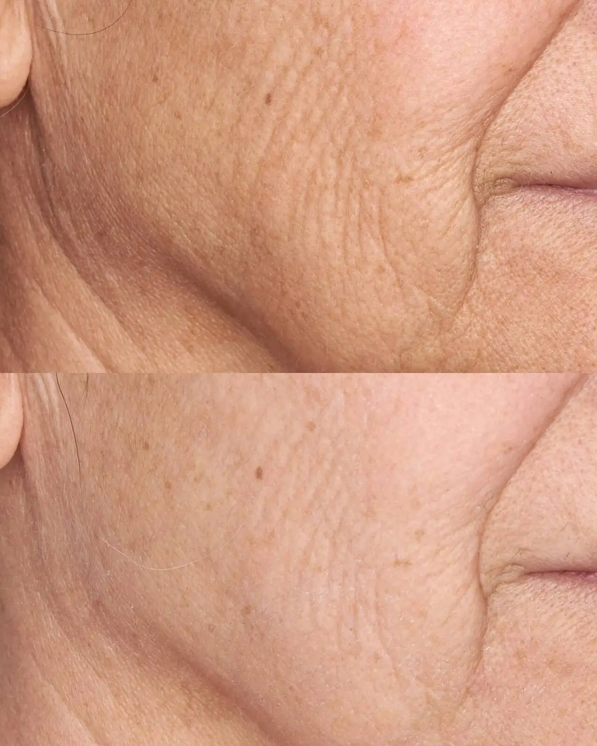 Perricone MD High Potency Face Finishing & Firming Moisturizer SPF 30 - Skin Love Cream