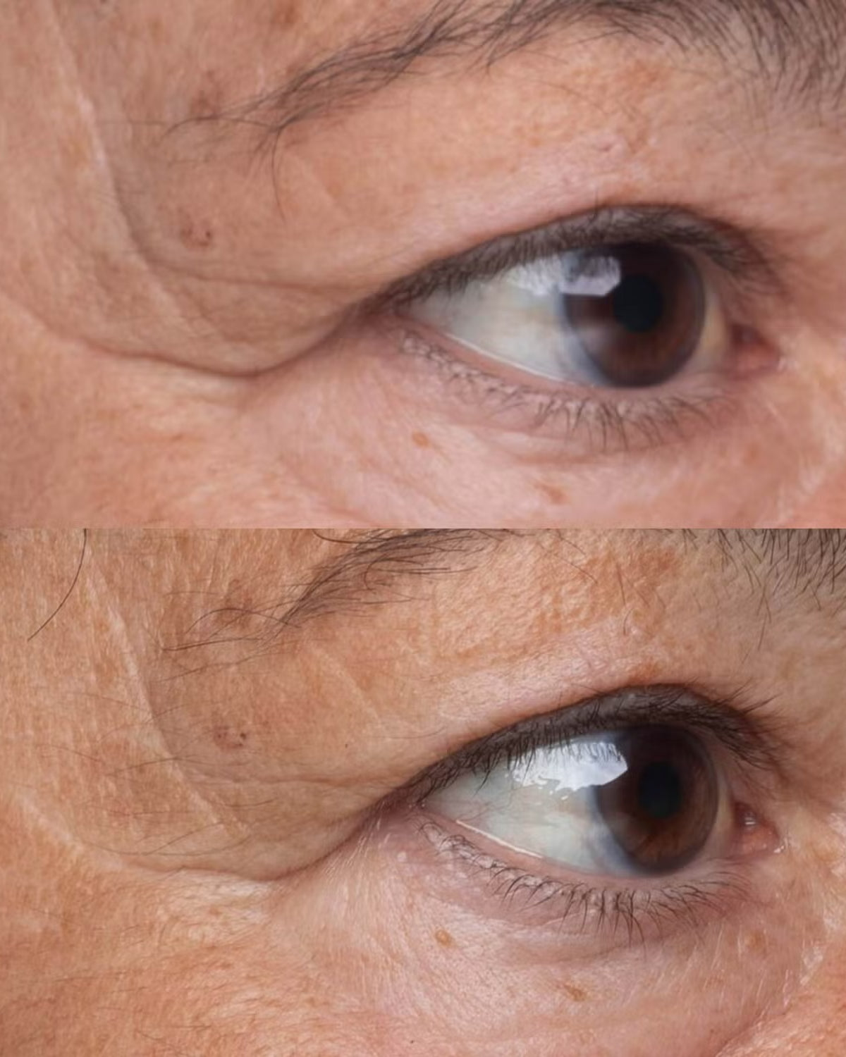 Perricone MD High Potency Growth Factor Firming & Lifting Eye Serum - Skin Love Cream