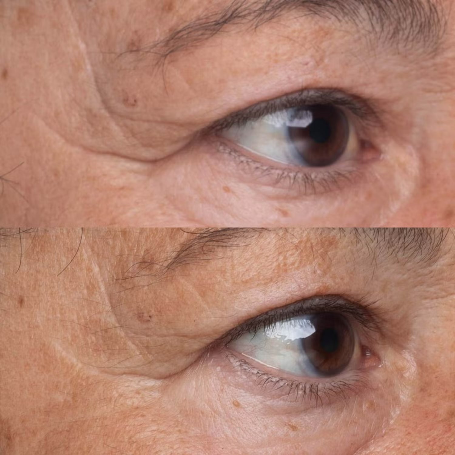 Perricone MD High Potency Growth Factor Firming & Lifting Eye Serum - Skin Love Cream