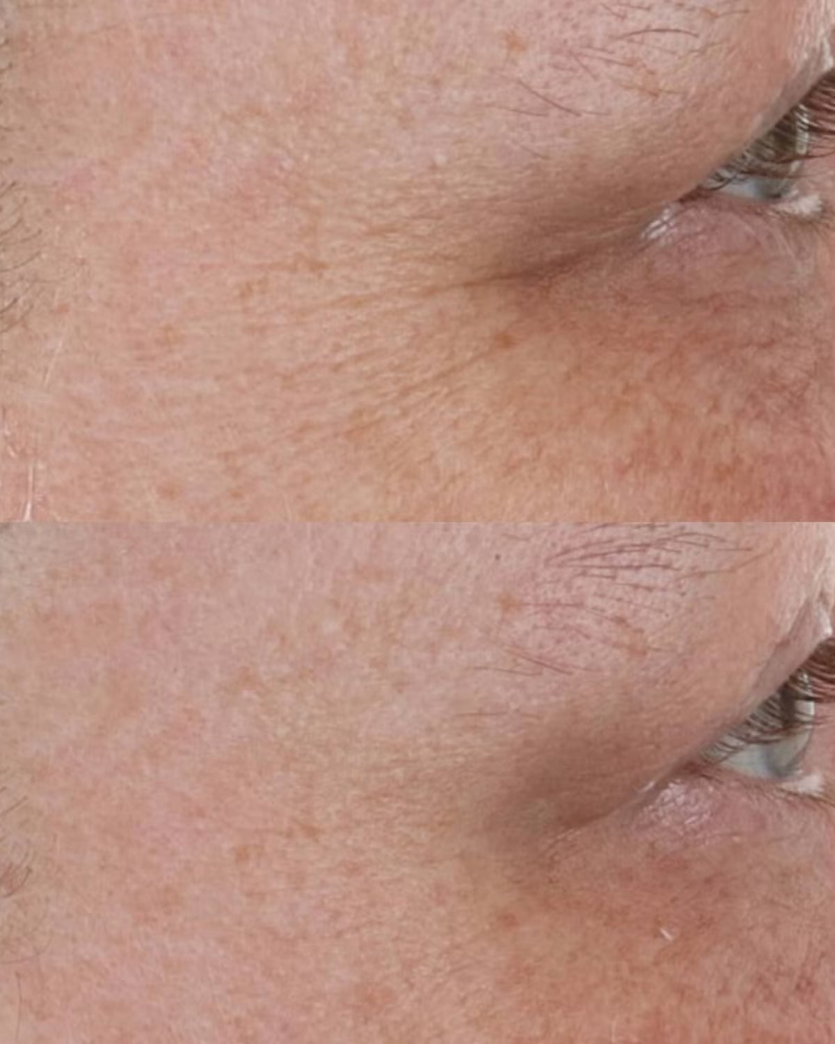 Perricone MD High Potency Retinol Recovery Overnight Moisturizer - Skin Love Cream