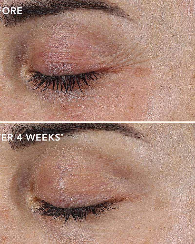 IMAGE Skincare AGELESS+ Retinol Repair Crème 0.3% Retinol Complex - Skin Love Cream