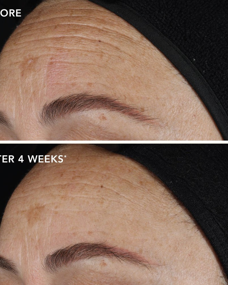 IMAGE Skincare AGELESS+ Retinol Pure Liquid Retinol 0.1% - Skin Love Cream