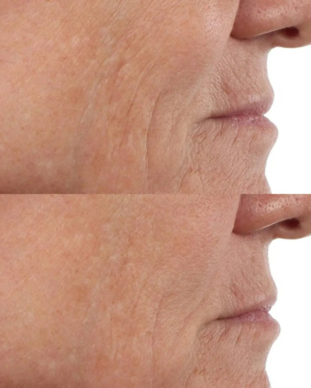 Perricone MD Vitamin C Ester CCC + Ferulic Brightening Complex 20% - Skin Love Cream