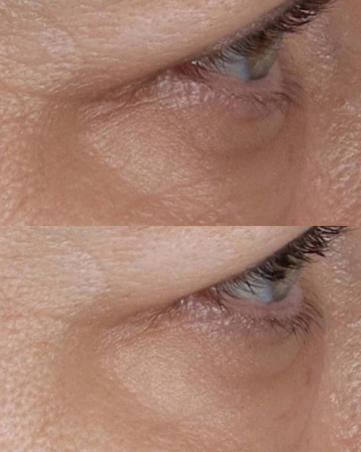 Perricone MD Vitamin C Ester CCC + Ferulic Brightening Under - Eye Cream - Skin Love Cream