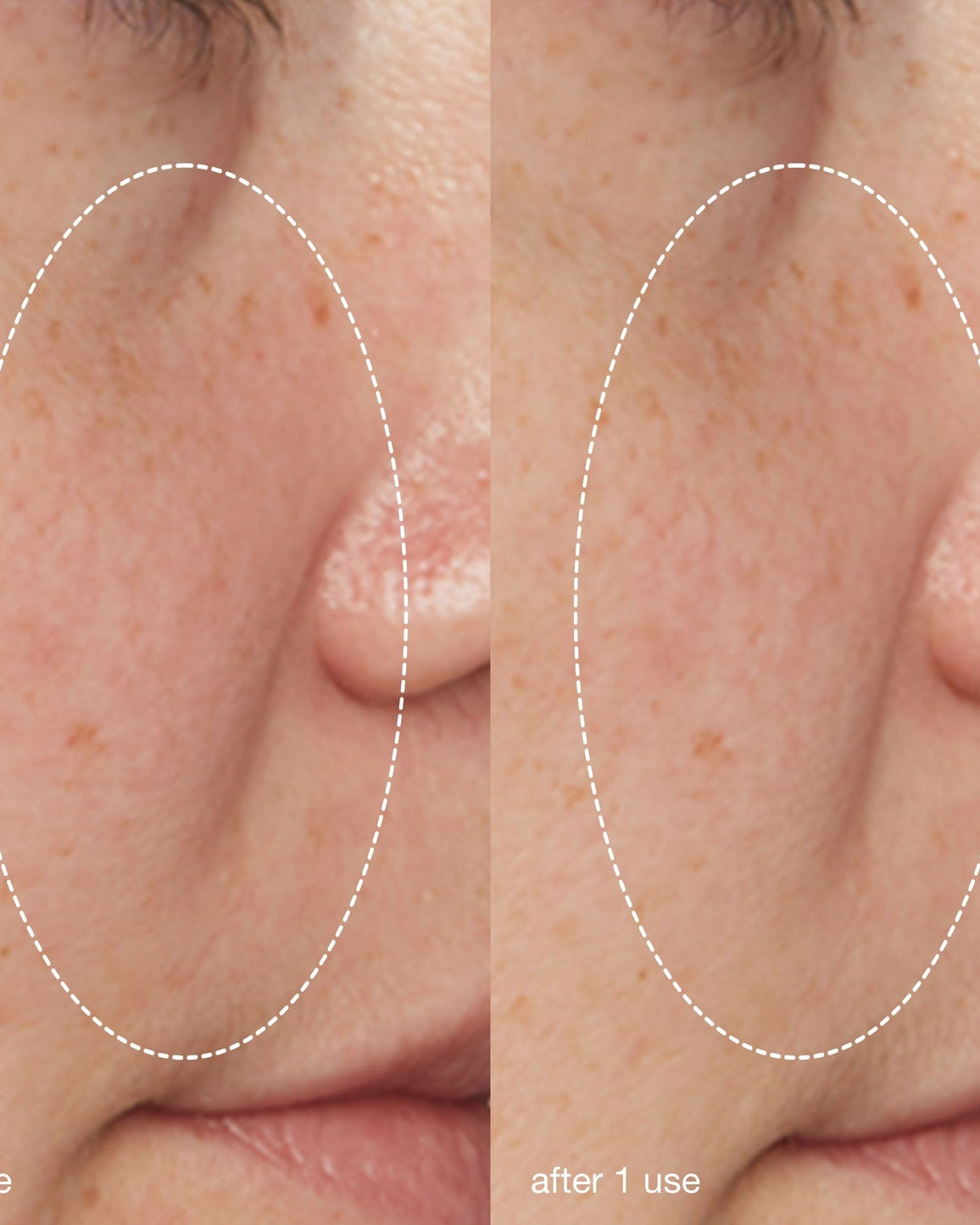 Dermalogica Liquid Peelfoliant - Skin Love Cream