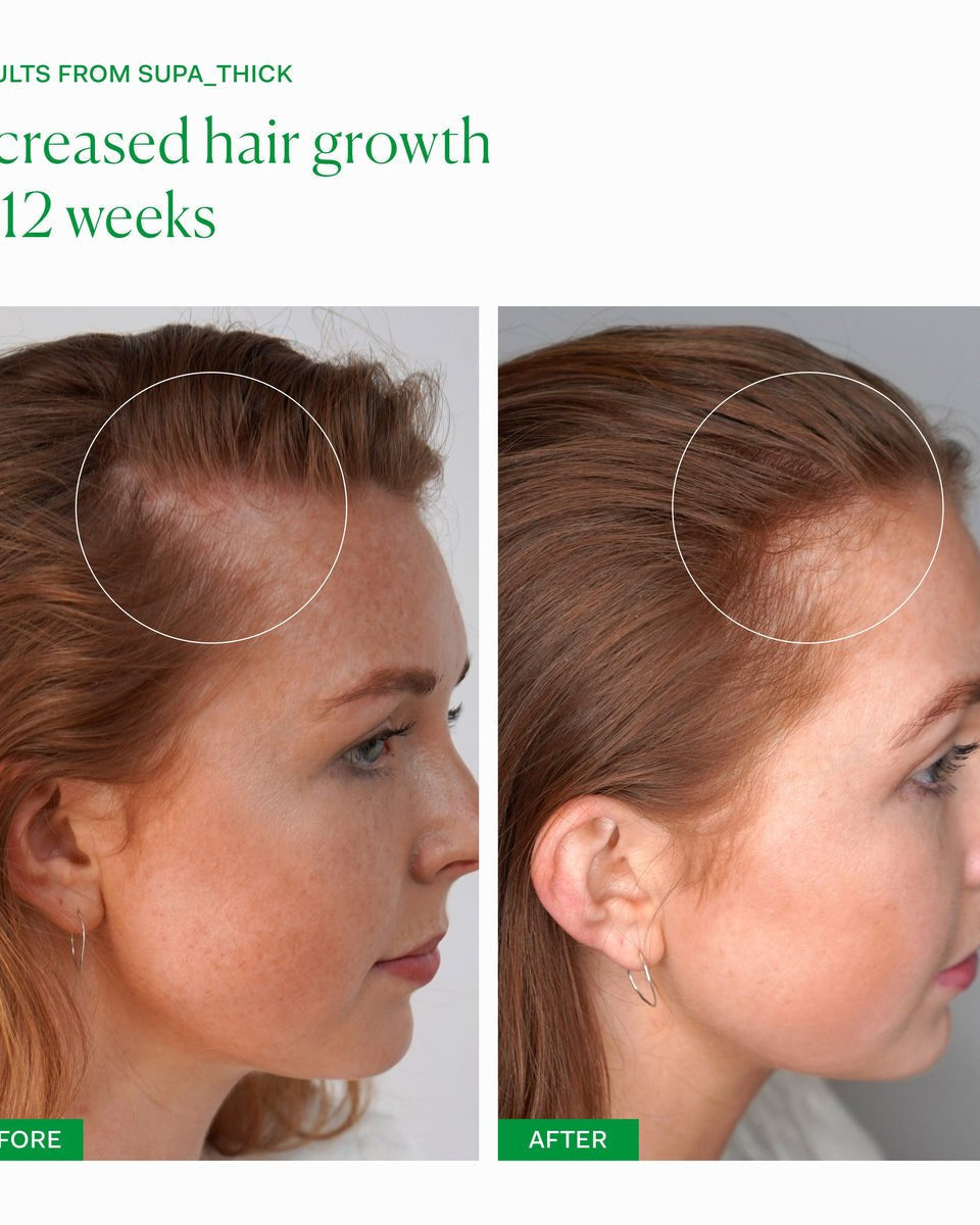 THE NUE CO Supa Thick Scalp Serum - Skin Love Cream