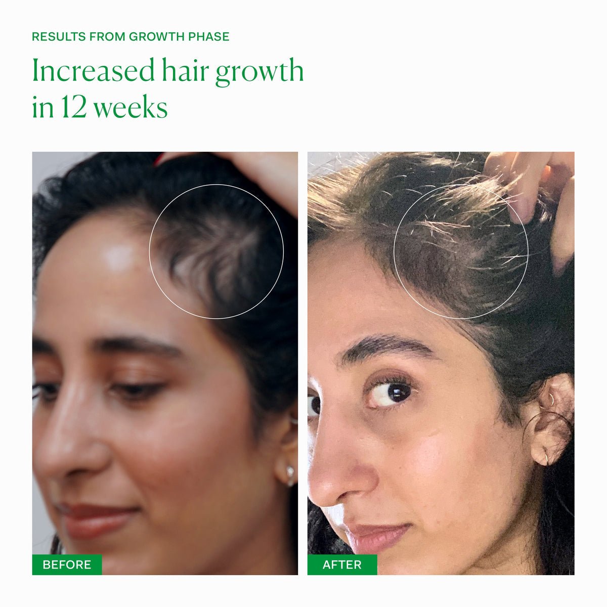 THE NUE CO Supa Thick Scalp Serum - Skin Love Cream