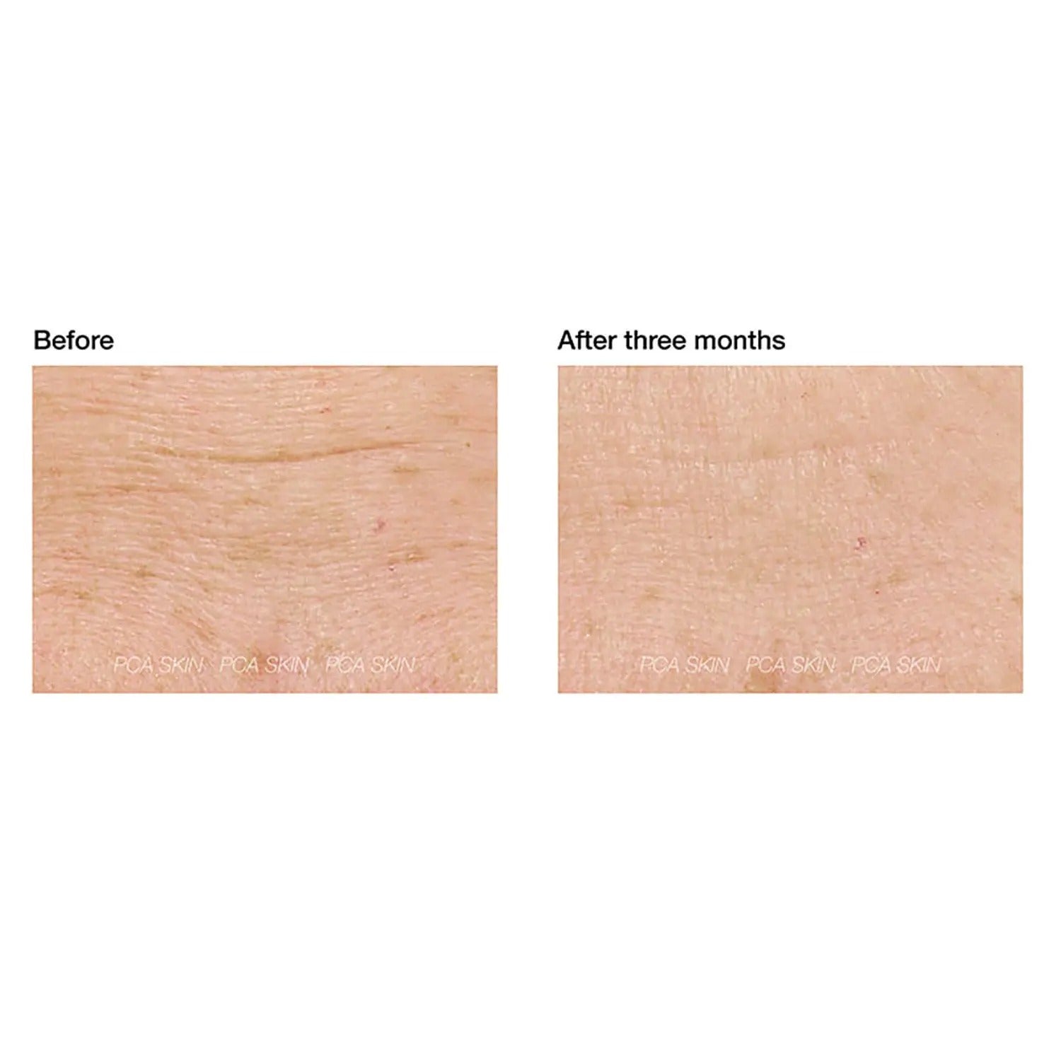 PCA Skin ExLinea Peptide Smoothing Serum - Skin Love Cream