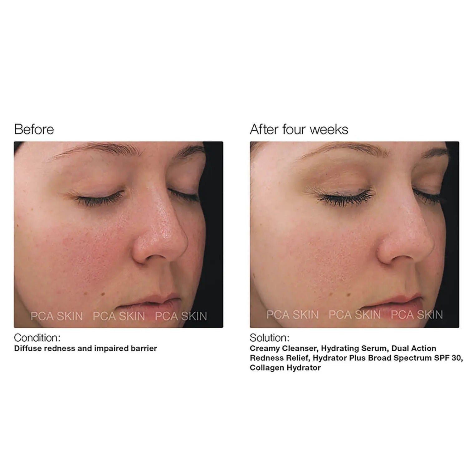 PCA Skin Dual Action Redness Relief - Skin Love Cream