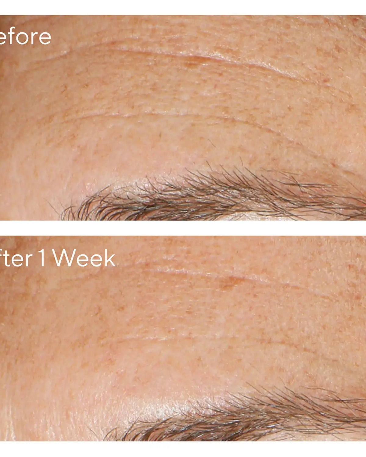 Murad Replenishing Multi - Acid Peel - Skin Love Cream