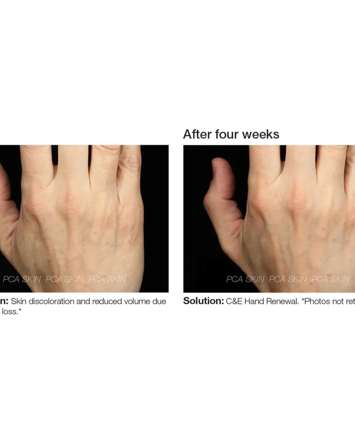 PCA Skin C&E Hand Renewal - Skin Love Cream