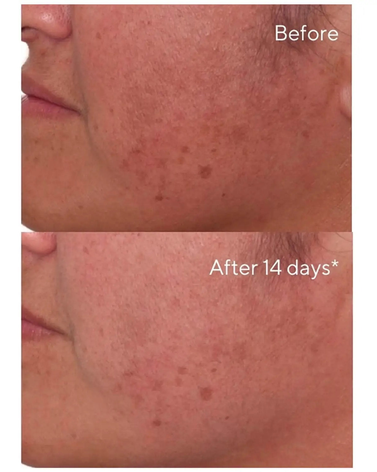 Murad Rapid Dark Spot Correcting Serum - Skin Love Cream