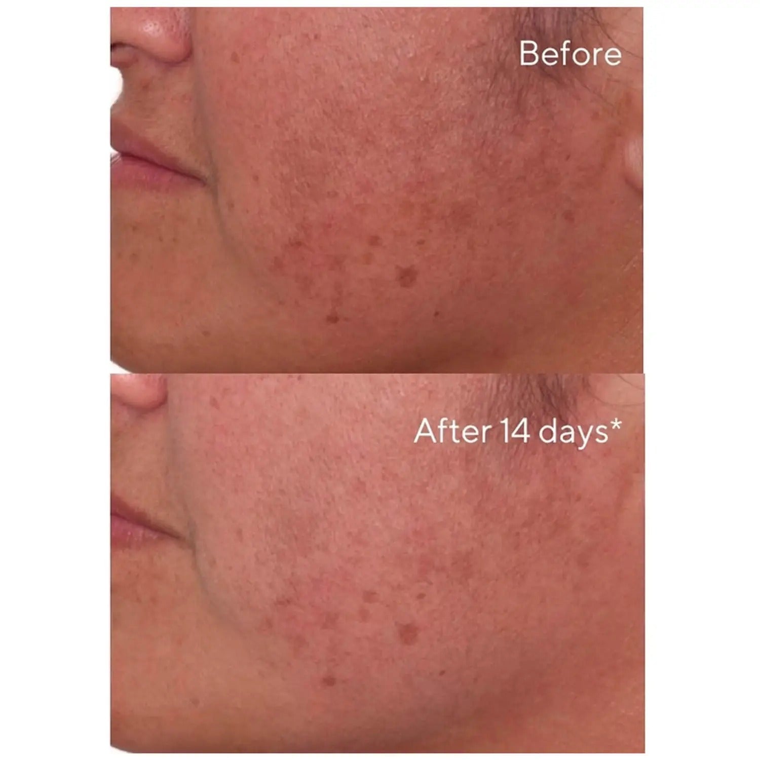 Murad Rapid Dark Spot Correcting Serum - Skin Love Cream