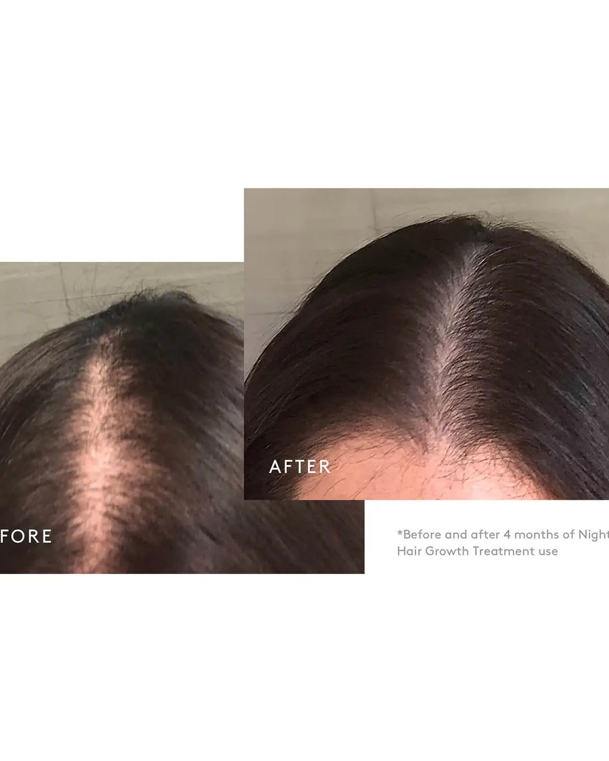 VIRTUE Flourish Nightly Intensive Hair Growth Treatment Hair Kit - Skin Love Cream