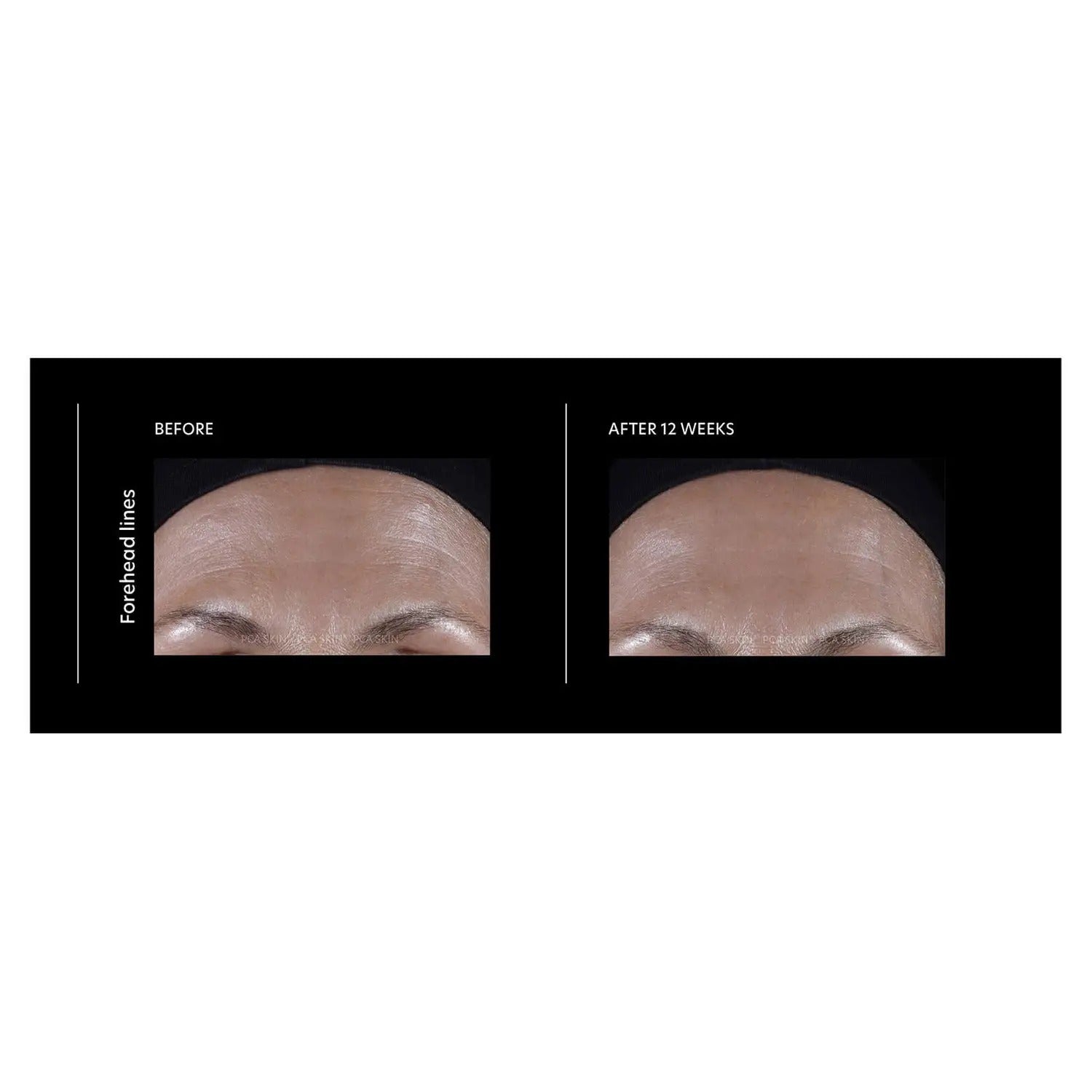 PCA Skin ExLinea Pro Peptide Serum - Skin Love Cream