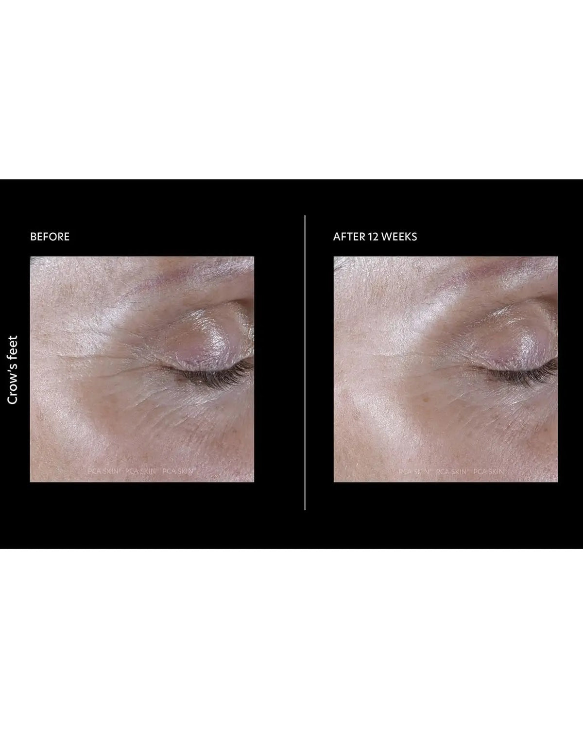 PCA Skin ExLinea Pro Peptide Serum - Skin Love Cream