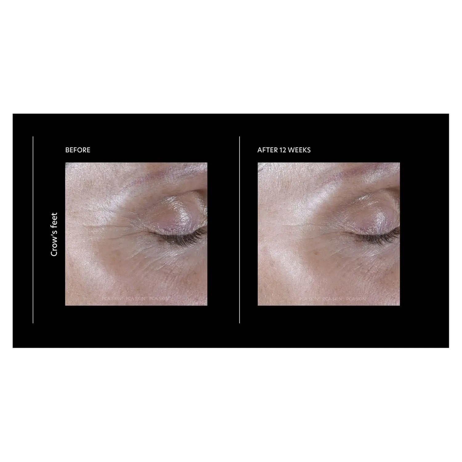 PCA Skin ExLinea Pro Peptide Serum - Skin Love Cream