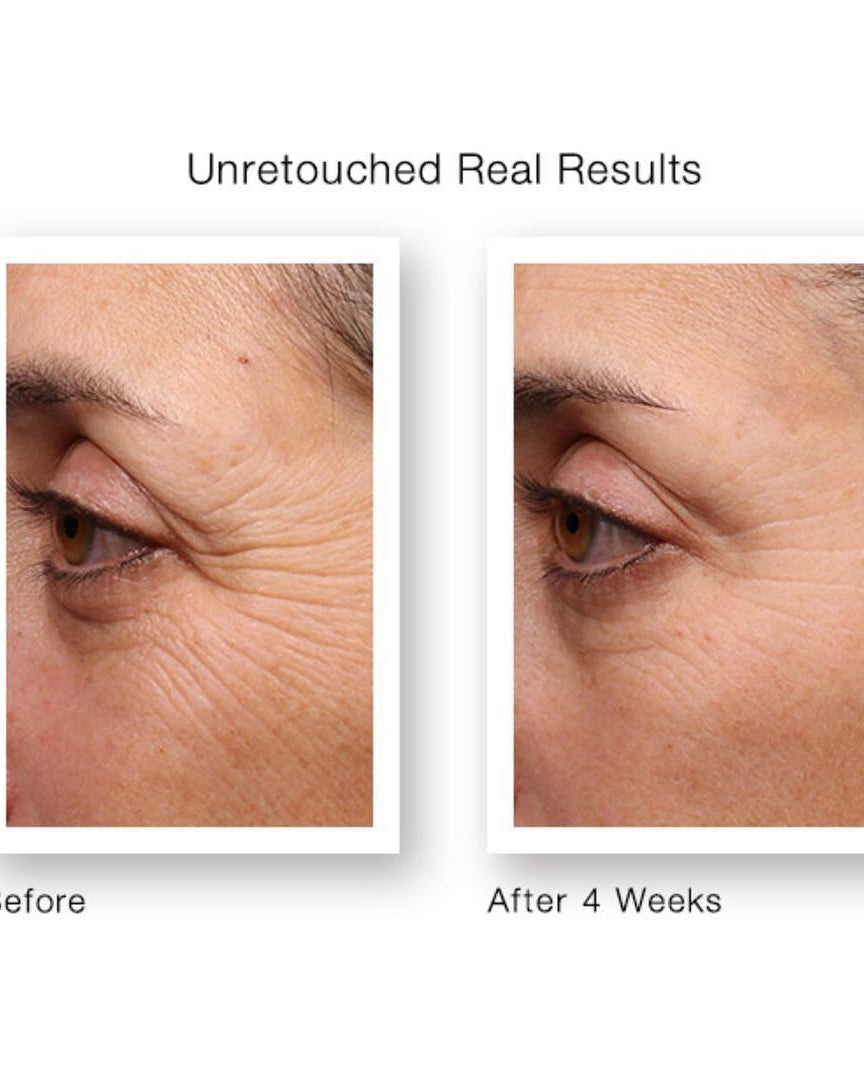 Murad Resurgence Renewing Eye Cream - Skin Love Cream