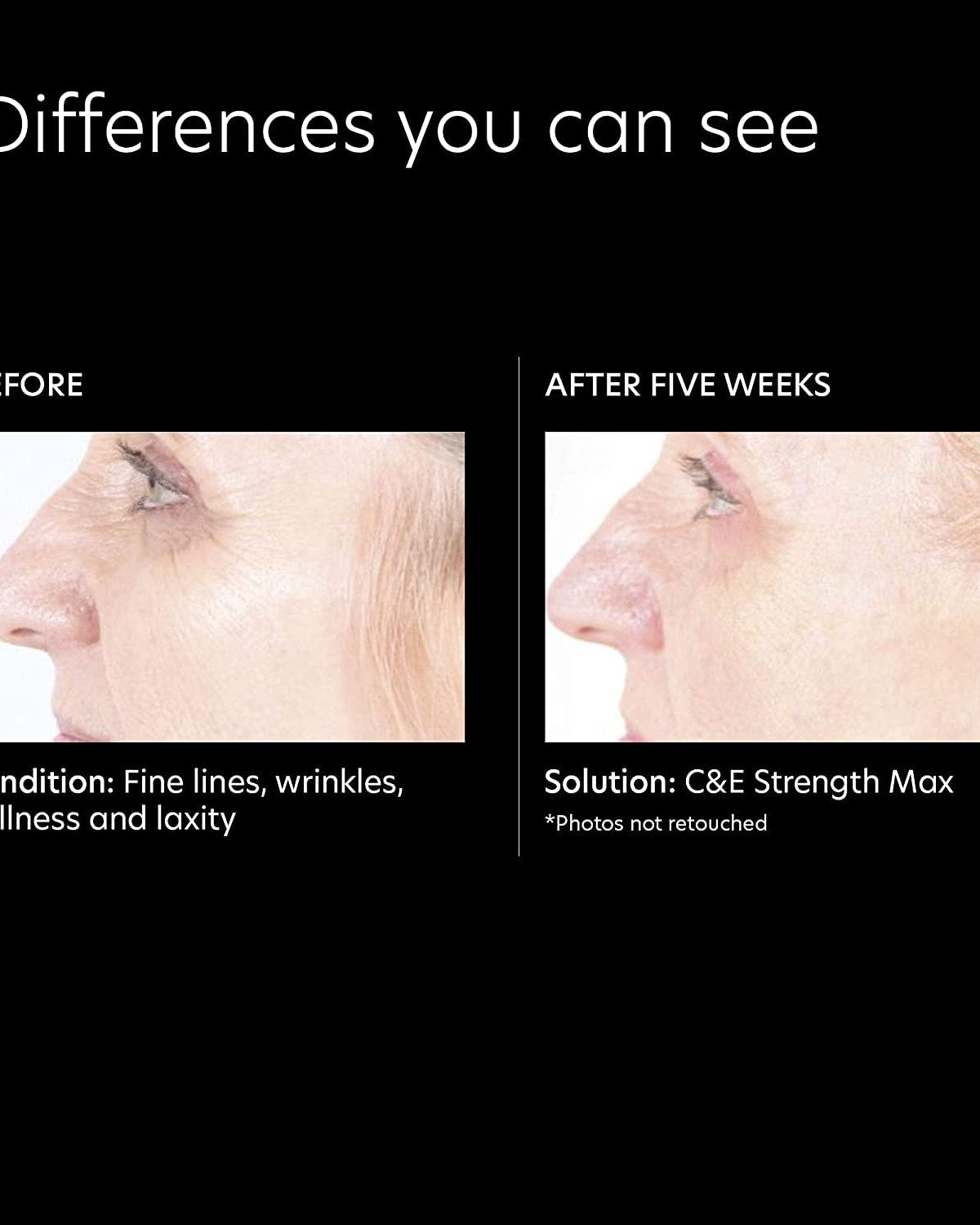 PCA Skin C&E Strength Max - Skin Love Cream