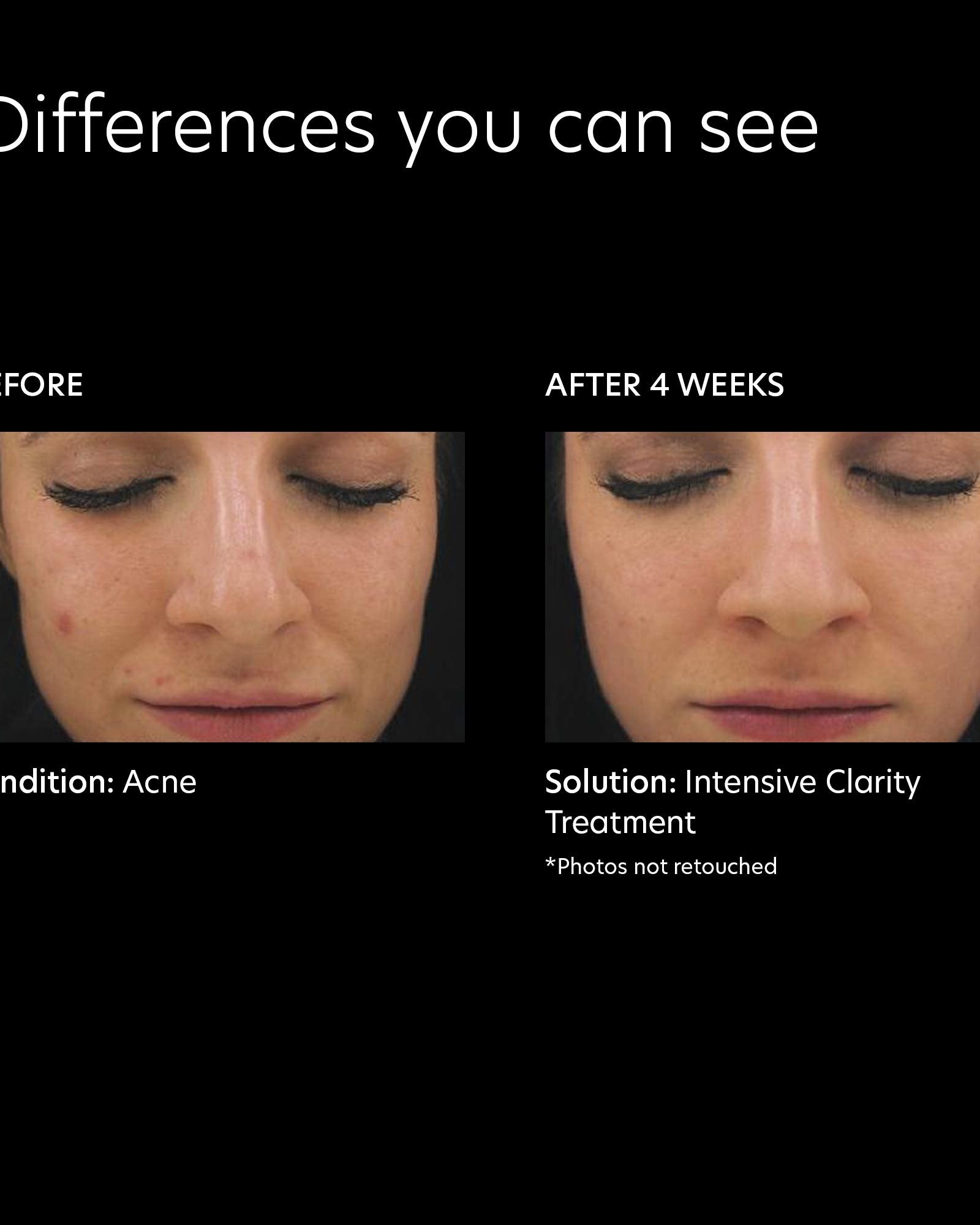 PCA Skin Intensive Clarity Treatment 0.5 Pure Retinol Night - Skin Love Cream