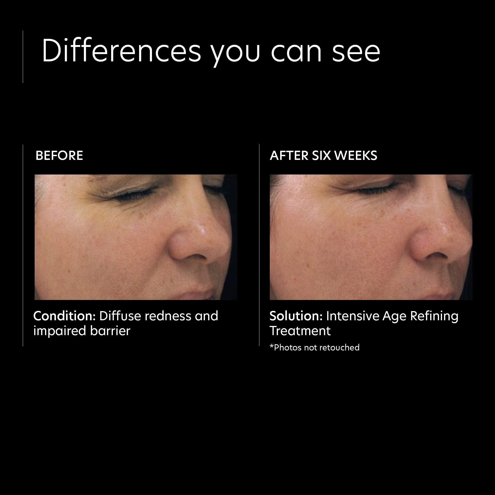 PCA Skin Intensive Age Refining Treatment 0.5 Pure Retinol Night - Skin Love Cream