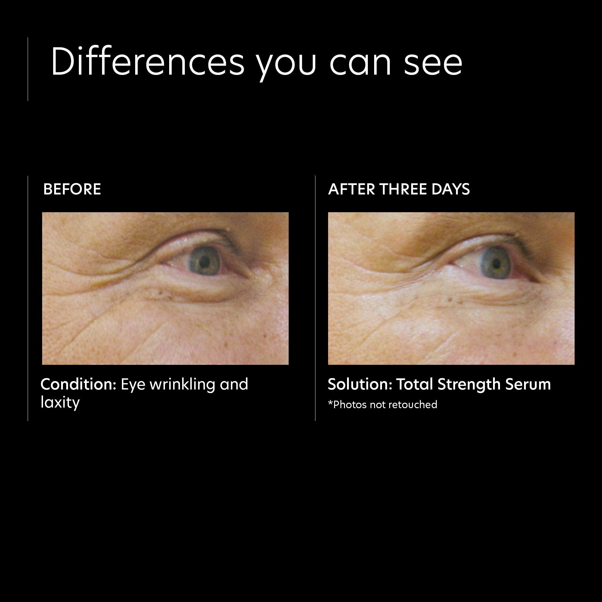 PCA Skin Total Strength Serum - Skin Love Cream