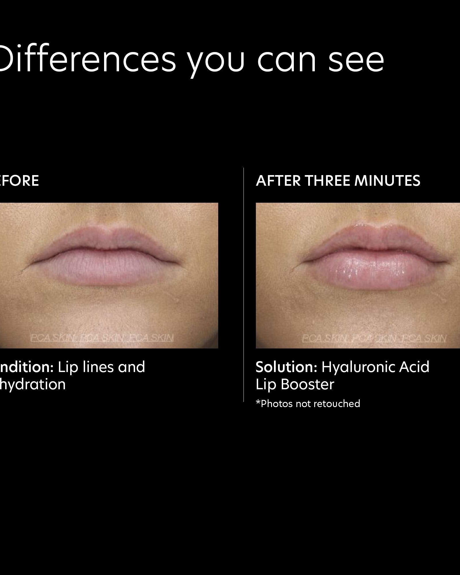 PCA Skin Hyaluronic Acid Lip Booster - Skin Love Cream