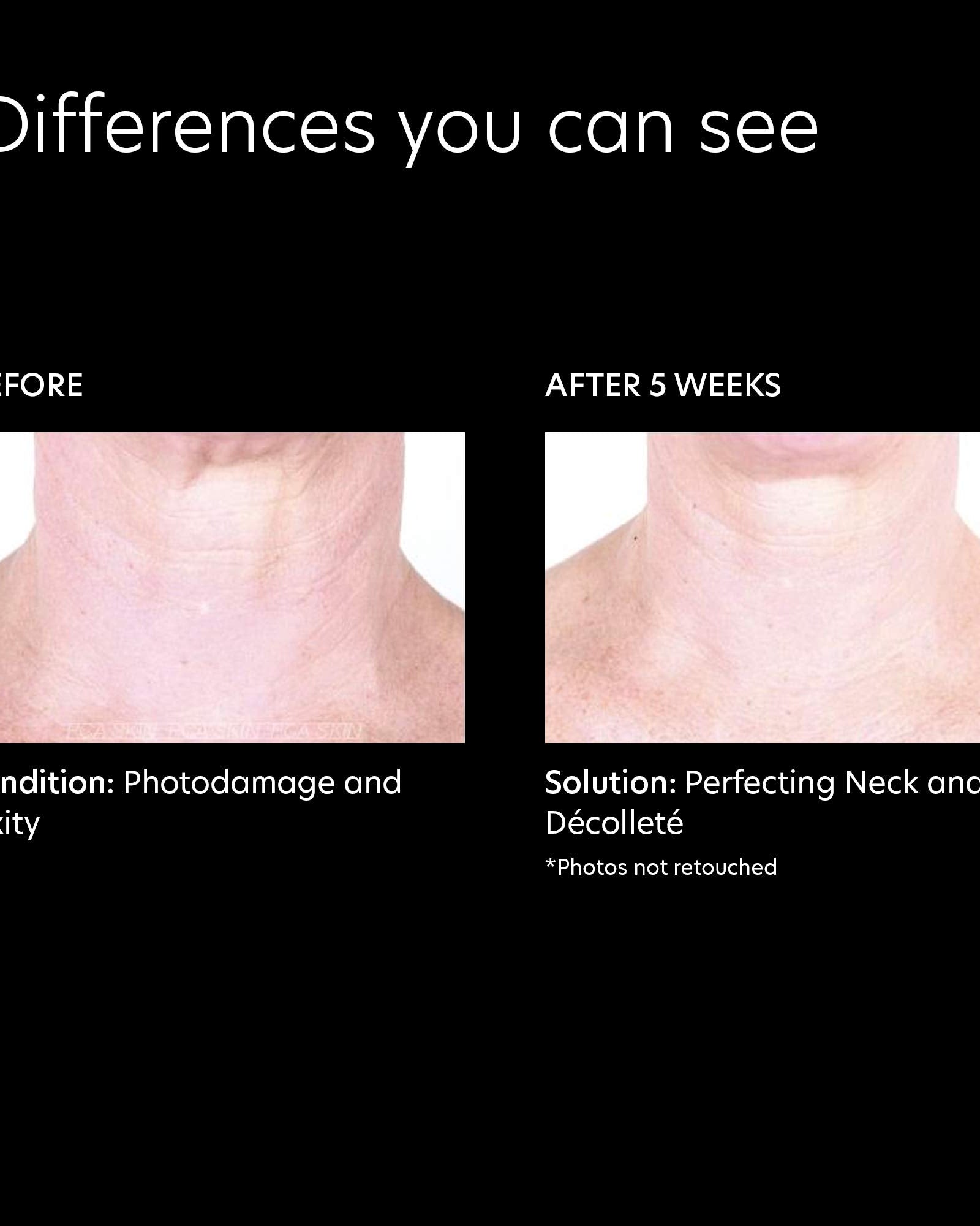 PCA Skin Perfecting Neck and Decollete - Skin Love Cream