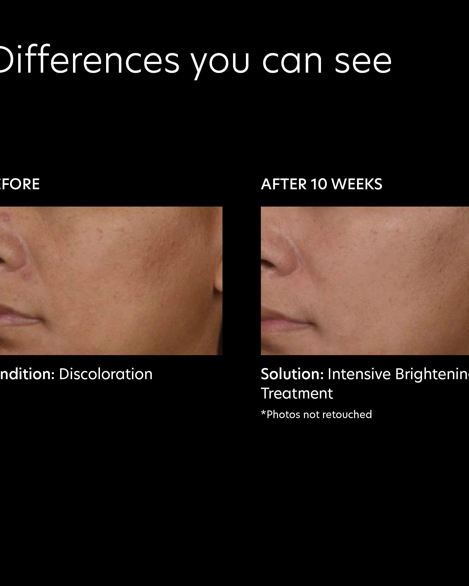 PCA Skin Intensive Brightening Treatment 0.5 Pure Retinol Night - Skin Love Cream