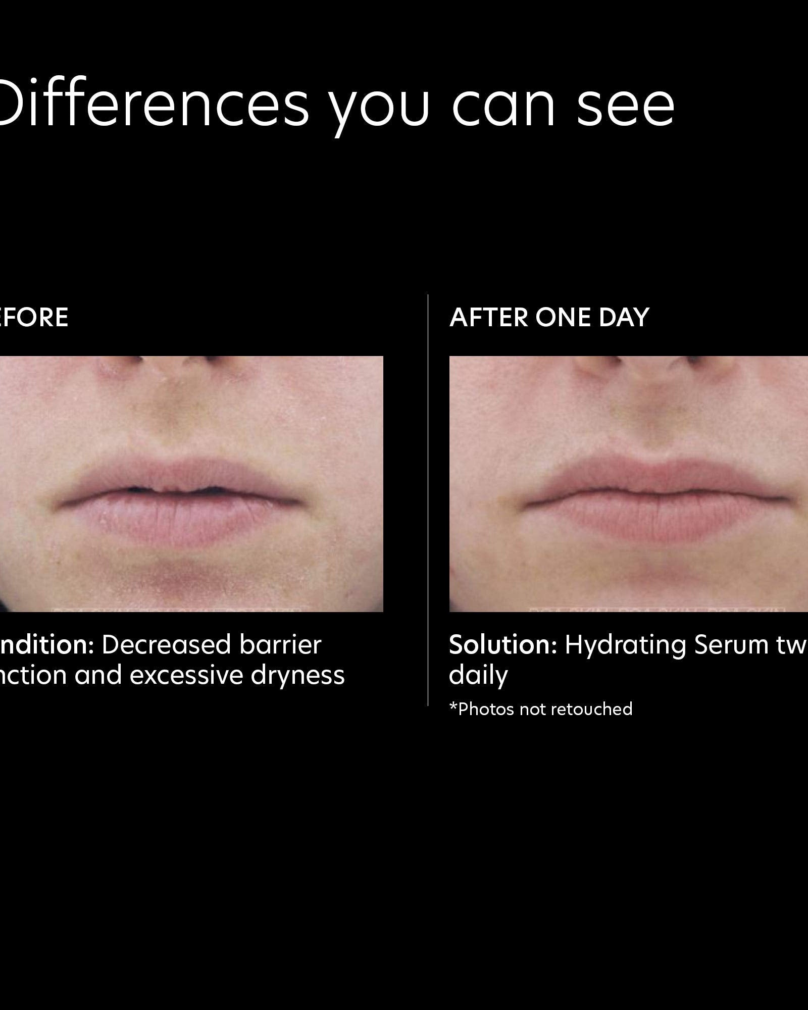 PCA Skin Hydrating Serum - Skin Love Cream