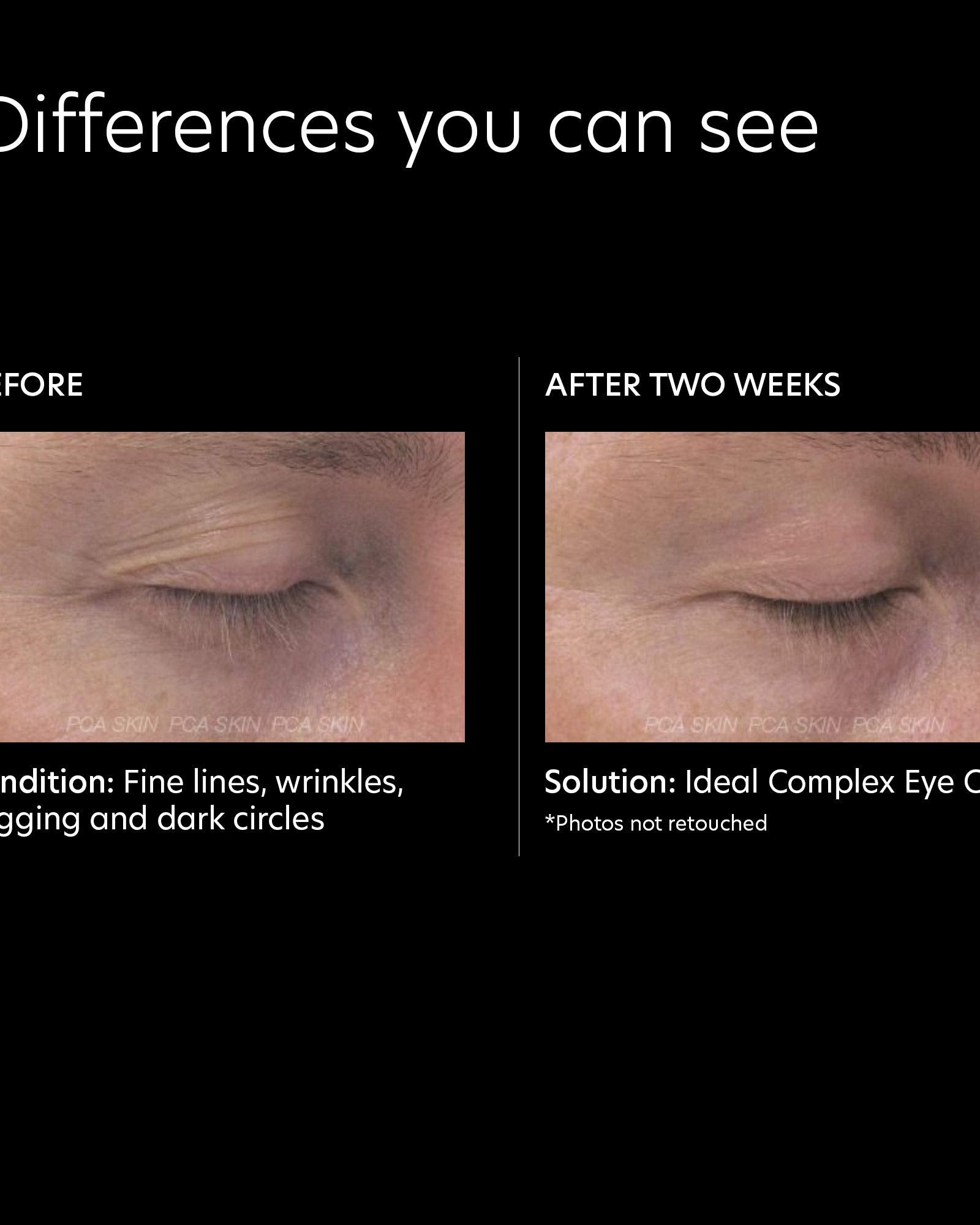 PCA Skin Ideal Complex Revitalizing Eye Gel - Skin Love Cream